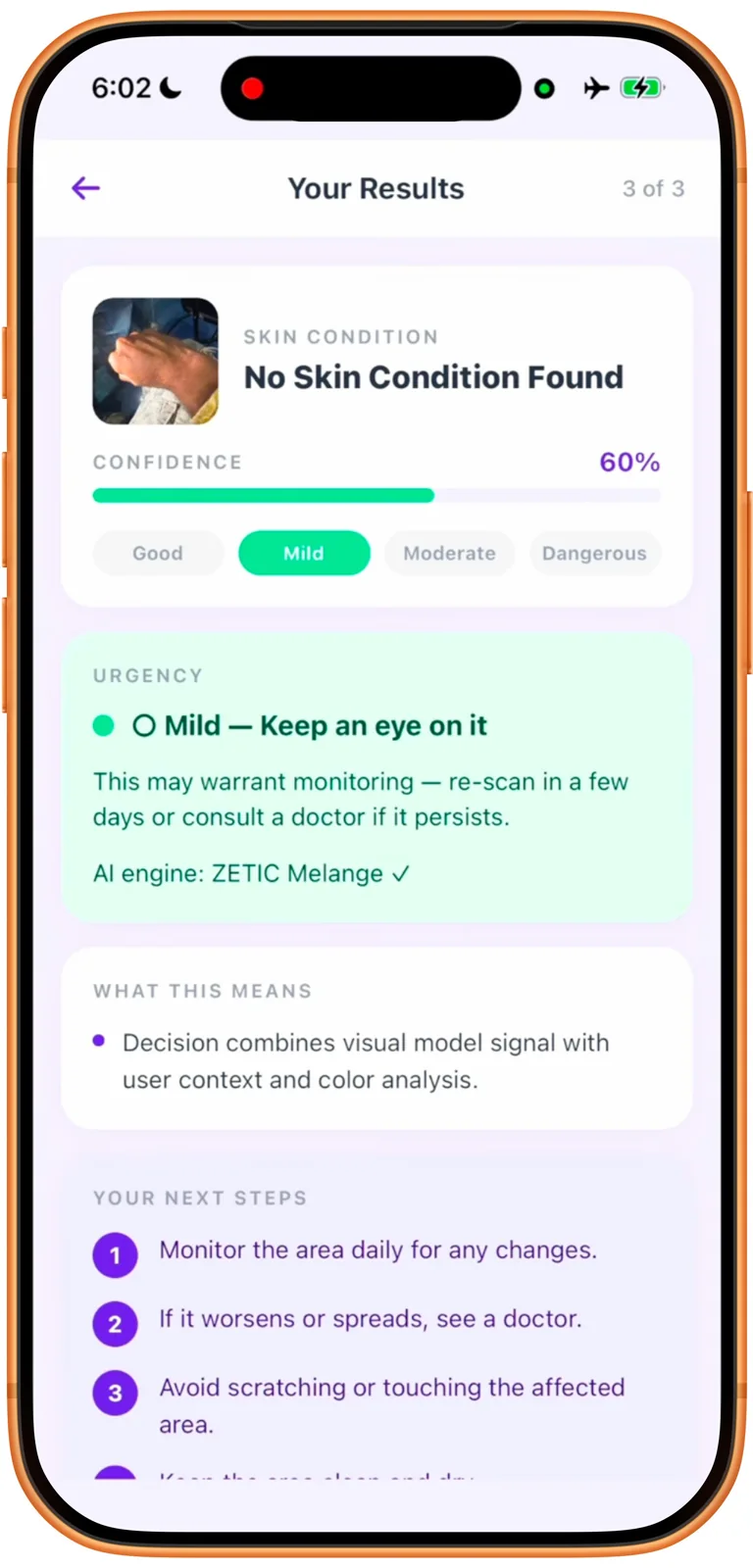 Skinpin app screenshot 4